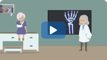 the-perspective-of-the-patient-with-osteoporosis